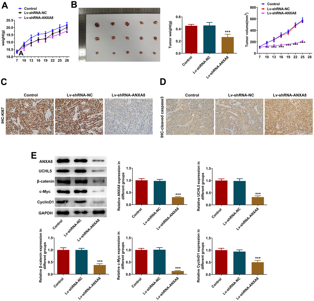 Interference with ANXA8 inactivated the Wnt/β-catenin signaling pathway through UCHL5 to inhibit tumor growth in OC mice. (A) The weight of the tumor in mice; (B) The volume of the tumor in mice; (C) IHC assay was used to detect the expression of KI67; (D) IHC assay was used to assess the expression of cleaved caspase3; (E) Western blotting was used to detect the expression of ANXA8, UCHL5, β-catenin, c-Myc, and CyclinD1 proteins.