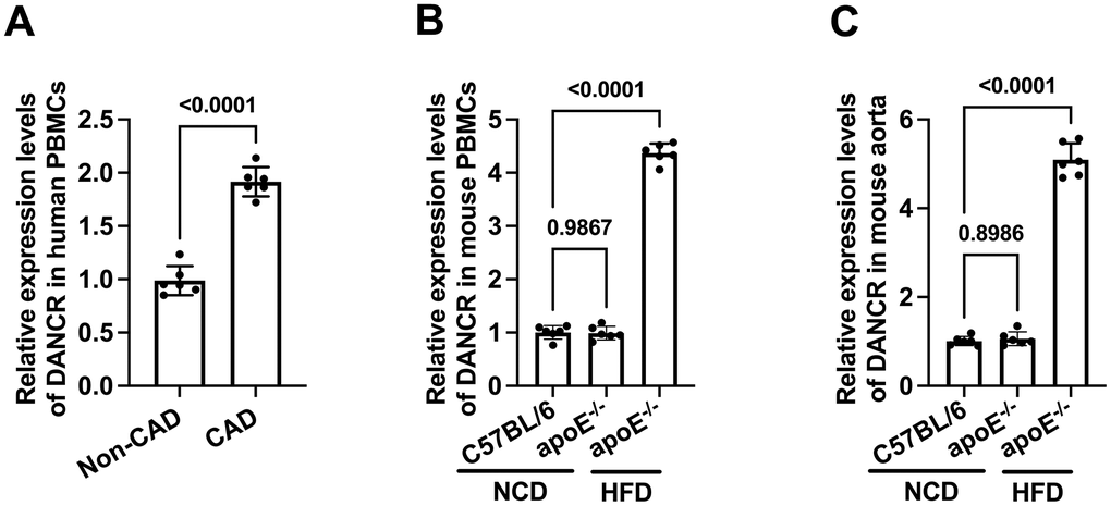The expression of DANCR in CAD patients and HFD-fed apoE-/- mice. (A) Detection of DACNR expression in PBMCs isolated from non-CAD and CAD patients. (B) Detection of DACNR levels in PBMCs from NCD- or HFD-fed or HFD-fed apoE-/- mice. (C) Detection of DACNR expression in the aorta from NCD- or HFD-fed apoE-/- mice. NCD, normal chow diet; HFD, high-fat diet. n=6.