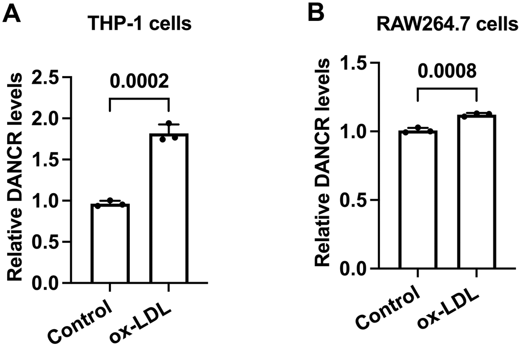 The expression of DANCR is increased in ox-LDL-treated human THP-1 macrophages and mouse RAW264.7 macrophages. (A, B) THP-1 cells were incubated with 160 ng/mL PMA for 48 h to differentiate into macrophages. Then, THP-1-derived macrophages or RAW264.7 macrophages were treated with 50 μg/mL ox-LDL for 24 h. qPCR was used to detect the expression of DANCR. All results are presented as the mean ± SD from three independent experiments performed in triplicate. n=3.