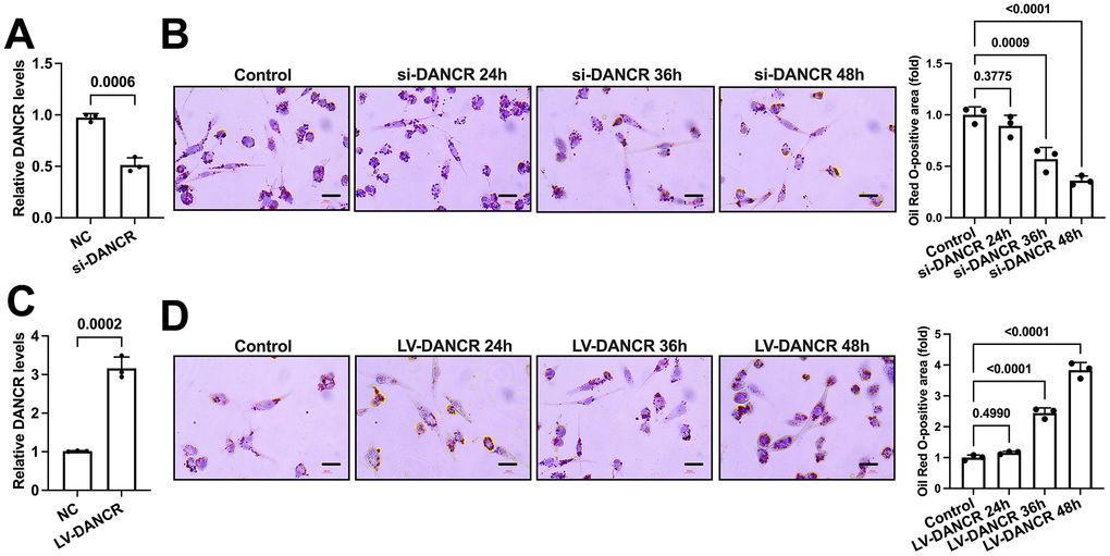 DANCR promotes lipid accumulation in THP-1 macrophages. (A) THP-1 macrophages were transfected with 20 μM si-DANCR or the negative control for 48 h. Transfection efficiency was determined by qPCR. (B) THP-1 macrophages were treated with 50 μg/mL ox-LDL for 24 h. Then, they were transfected with 20 μM si-DANCR for 24 h, 36 h, and 48 h, respectively. Oil Red O staining was used to detect lipid droplets. Image-Pro Plus software calculated Oil Red O-positive areas. (C) THP-1 macrophages were transfected with 1×1010 TU/mL LV-DANCR or the negative control for 48 h. Transfection efficiency was determined by qPCR. (D) THP-1 macrophages were treated with 50 μg/mL ox-LDL for 24 h. Then, they were transfected with 1×1010 TU/mL LV-DANCR for 24 h, 36 h, and 48 h, respectively. Oil Red O staining was used to detect lipid droplets. Image-Pro Plus software calculated Oil Red O-positive areas. All results are presented as the mean ± SD from three independent experiments performed in triplicate. Scale bar=200 μm.
