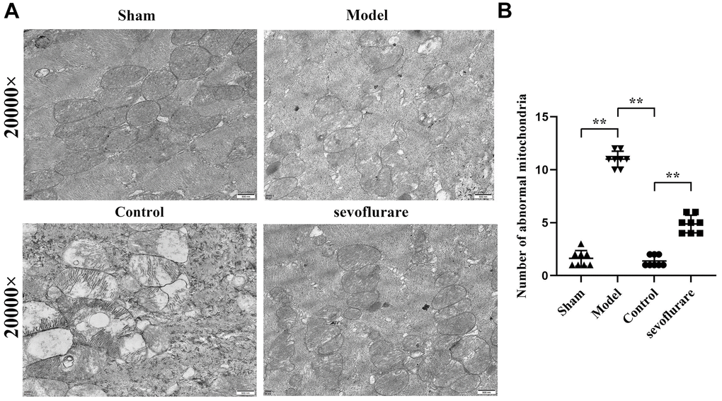 Representative transmission electron microscopic images of mouse lumbosacral spinal cord tissue. (A) Results of transmission electron microscopy, (B) mitochondrial number statistics. Sham group vs. Model group, Model group vs. Sevoflurane group, Control group vs. Sevoflurane group, N=8.