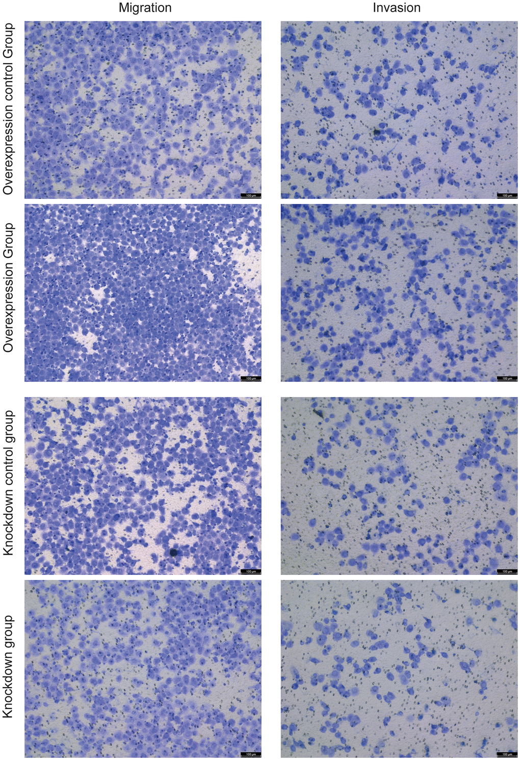 The effects of overexpression and knockdown of HNRNPC on the migration (left) and invasion (right) of NCI-H1299 cells were detected by cell scratch assay.