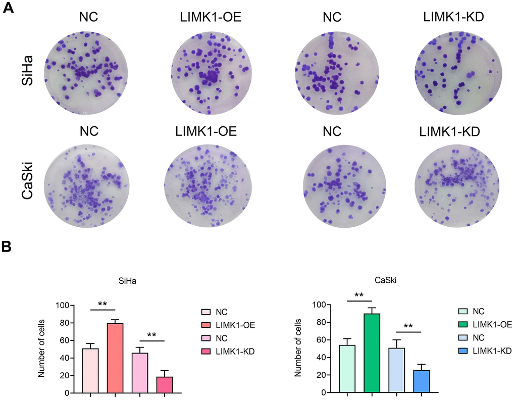 LIMK1 promoted the proliferation of cervical cancer cells. (A) Representative images of SiHa and CaSki cell monoclonal experiments. (B) The results of the clonal formation assay showed that LIMK1 overexpression promoted the formation of cell clones and increased the number of colonies. LIMK1 knockdown inhibited the formation of cell clones, resulting in a decrease in the number of colonies. **P