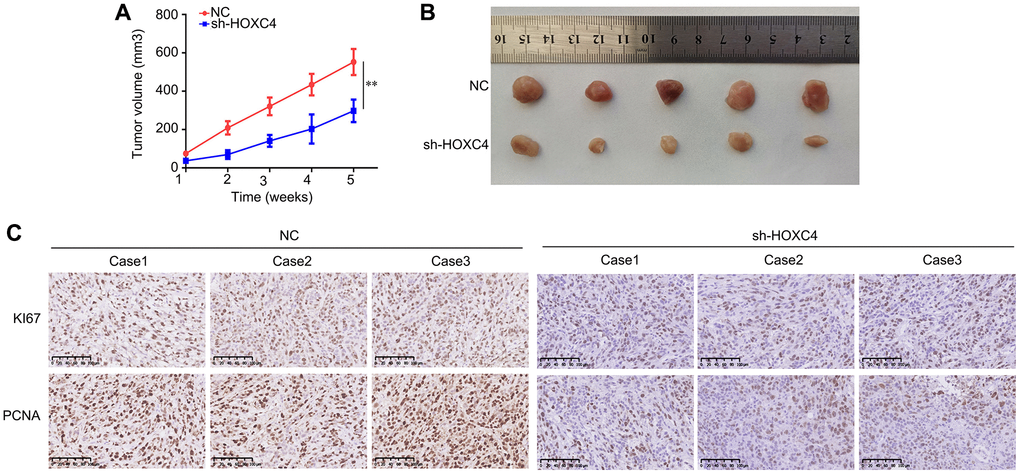 HOXC4 knockdown inhibits the proliferation of PANC-1 cells in vivo. (A) Growth curve of the tumors in the HOXC4 knockdown and control groups. (B) Images of the tumors. (C) Expression of Ki67 and proliferating cell nuclear antigen in HOXC4 knockdown and normal control tissues. **P 