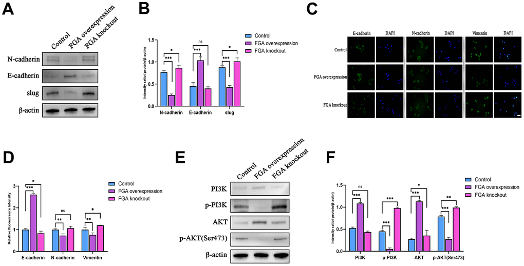 FGA inhibits the epithelial-mesenchymal transition (EMT) through the PI3K/AKT signaling pathway. (A) Western blot analysis of the expression levels of key EMT proteins (E-cadherin, N-cadherin, slug) in the control group, FGA knockout group and FGA overexpressed group, and their quantitative analysis (B). (C) Immunofluorescence staining of the expression levels of E-cadherin, N-cadherin, and vimentin proteins in the control group, FGA knockout group and FGA overexpressed group, and their quantitative analysis (D). (E, F) Western blot analysis of the expression levels of proteins related to the PI3K/AKT signaling pathway in the control group, FGA knockout group and FGA overexpressed group, and their quantitative analysis. (mean ± SD, n = 3; *P 