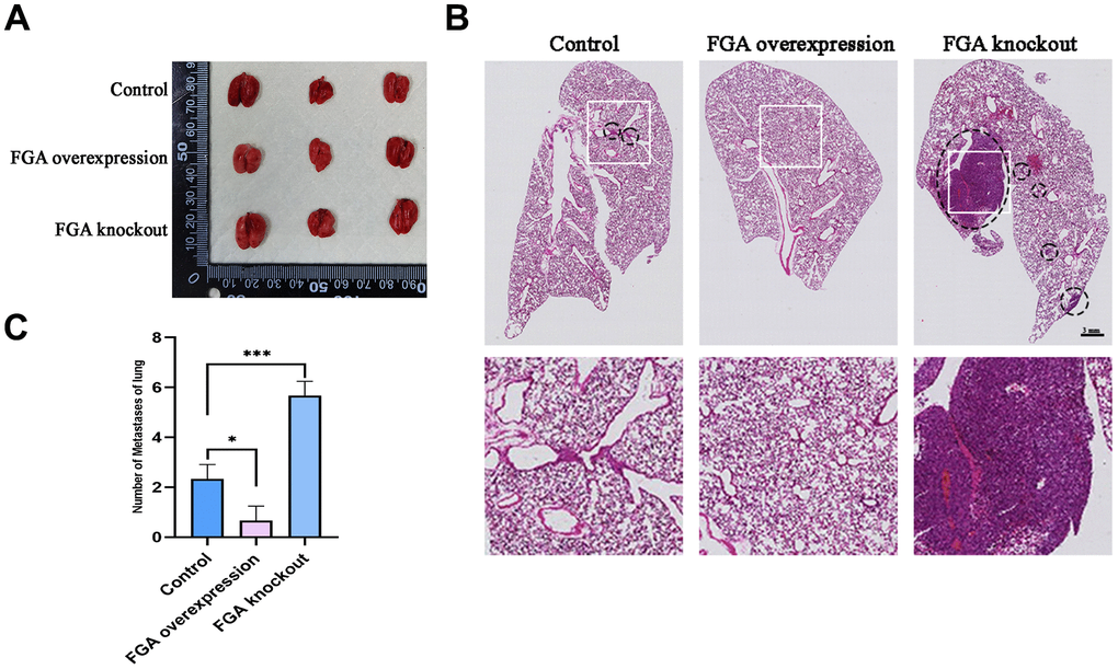 The impact of FGA on HCC metastasis in vivo. (A) Representative photographs of the lungs. (B) Representative images of lung biopsy, stained with H&E. Within the circle are metastatic cancer lesions. (C) Numbers of metastases of lung in each group. (mean ± SD, n = 3; *P 