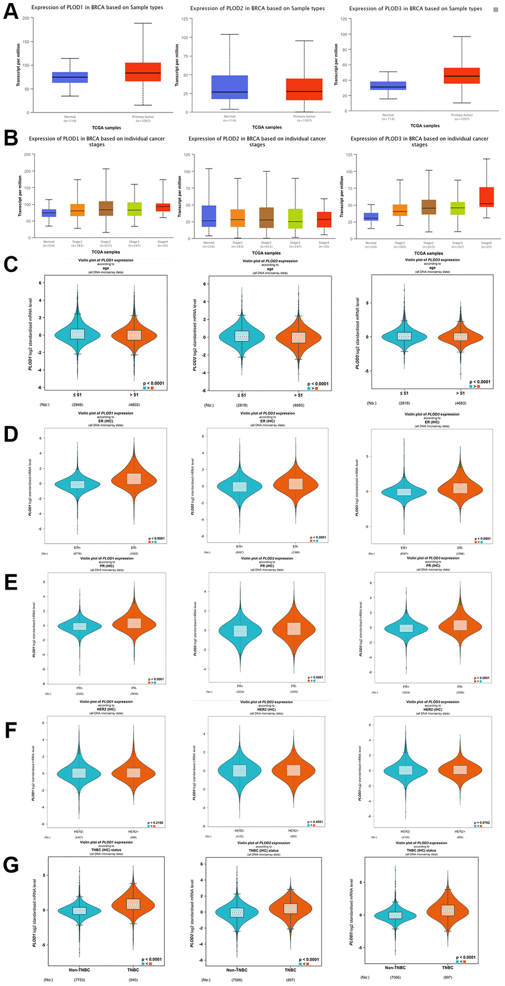 The expression of PLOD family genes in breast cancer using UALCAN database. (A) The expression of PLOD1, PLOD2 and PLOD3 in breast cancer tissues and normal tissues; (B) The expression of PLOD1, PLOD2 and PLOD3 in different clinical stages of breast cancer; bc-GeneExMiner 4.6 analyze the PLOD family genes in different clinical status. (C) Age; (D) ER; (E) PR; (F) Her-2; (G) TNBC.