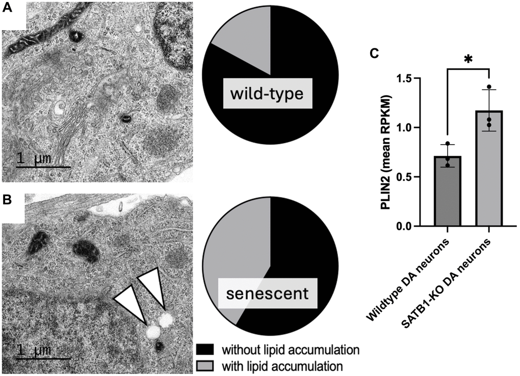 Quantification of lipid accumulation and PLIN2 expression in human stem cell derived DA neurons. Representative TEM images of a mature wild-type (A) and SATB1-KO (senescent) DA neurons (B). Pie charts show the quantification of cells containing LD-like structures. White arrowheads indicate LD-like structures. N = 3, n = 29 per genotype. Scale bar = 1 um. (C) PLIN2 expression in wildtype and SATB1-KO (senescent) DA neurons. Student’s t-test was performed. *p 