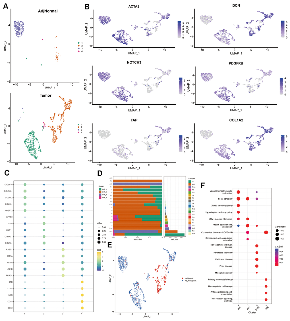 Profiling of CAF subpopulations. (A) UMAP plot displaying the distribution of four distinct CAF subpopulations post-clustering. (B) UMAP plot illustrating the expression of CAF marker genes (ACTA2, FAP, PDGFRB, NOTCH3, DCN, and COL1A2). (C) Dot plot showcasing the top 5 marker gene expressions across the four CAF clusters. (D) Relative proportions and cell numbers within each sample for the four CAF clusters. (E) UMAP plot delineating the distribution between malignant and non-malignant cells. (F) KEGG enrichment analysis of DEGs observed across the four CAF clusters.