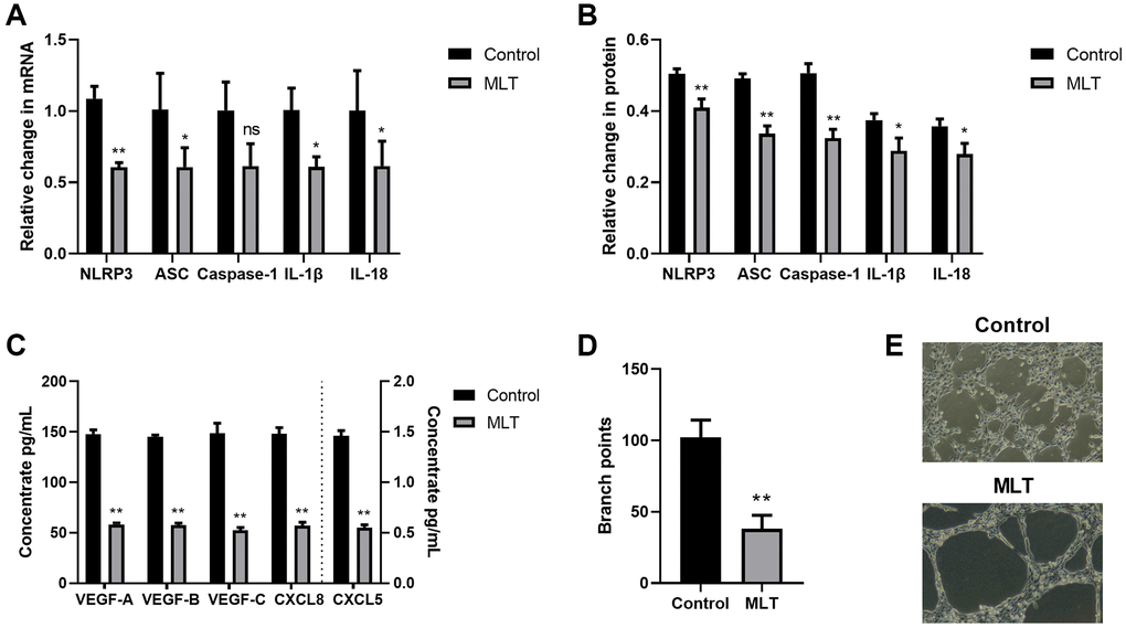 Melatonin strongly inhibited angiogenesis and lymphangiogenesis via the NLRP3 inflammasomal axis. (A) The NLRP3, ASC, Caspase-1, IL-1β, and IL-18 transcript expressions in the melatonin-treated and control cells, as evidenced by RT-PCR. (B) The NLRP3, ASC, Caspase-1, IL-1β, and IL-18 protein expressions in the melatonin-treated and control cells, as evidenced by western blot assay. (C) The VEGF-A, VEGF-B, VEGF-C, CXCL8, and CXCL5 protein contents in the melatonin-treated and control cells, as evidenced by ELISA. (D, E) Branch point quantification. Typical phase-contrast images revealing tube formation. *p **p n = 3).