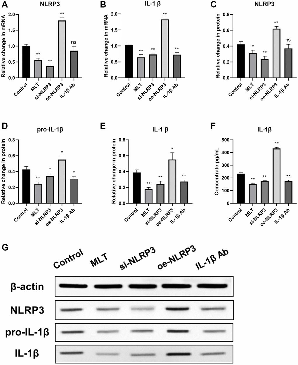 Melatonin inhibited the expression of the NLRP3 pathway in tumor tissues and peripheral blood of mice. (A, B) mRNA expression levels of NLRP3 pathway components (NLRP3 and IL-1β) in tumor tissues evaluated by RT-PCR. (C–F) Protein expression levels of NLRP3 pathway components (NLRP3, pro-L-1β and IL-1β) in tumor tissues assessed by western blotting. (G) Expression levels of IL-1β in peripheral blood of mice analyzed by ELISA. *p **p n = 3).