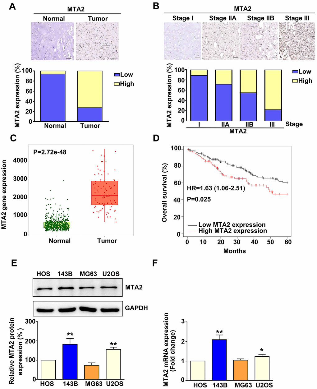 MTA2 overexpression in human osteosarcoma tissue and osteosarcoma cell lines is associated with poor prognosis in osteosarcoma patients. (A) Representative immunohistochemistry (IHC) results of MTA2 staining in normal and osteosarcoma specimens. Low: low expression of MTA2; High: high expression of MTA2. Scale bar: 50 μm. (B) Representative IHC results of MTA2 staining in human osteosarcoma specimens of different tumor stages. (C) Comparison of MTA2 expression between normal and tumor tissues from osteosarcoma patients using TNMplot from the TCGA database. (D) Kaplan–Meier analysis of overall survival in osteosarcoma patients with high and low MTA2 expression levels. (E, F) Protein and mRNA expression of MTA2 in 4 human osteosarcoma cell lines, as assessed using western blot and RT-qPCR assays. ** P 