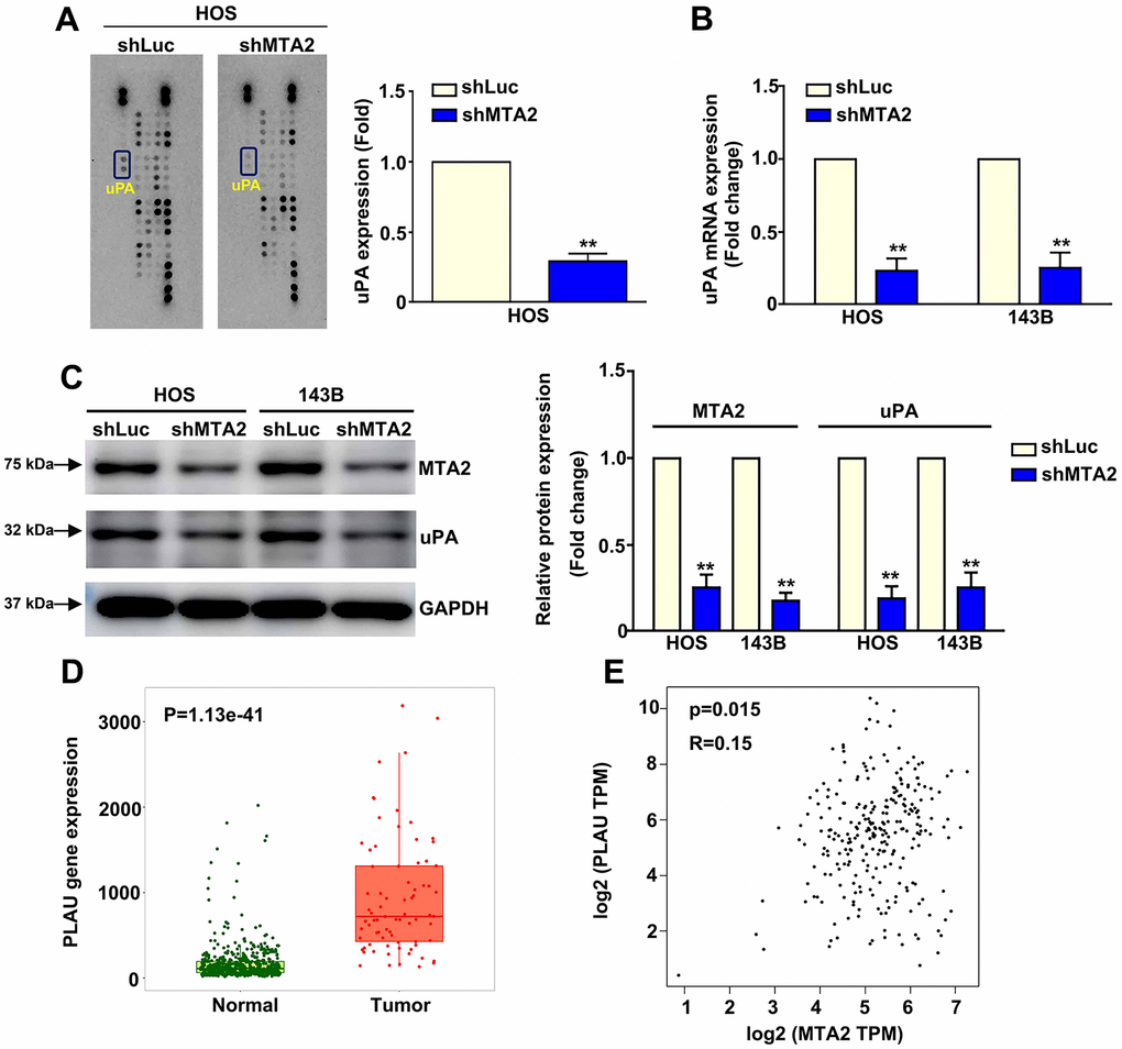 MTA2 depletion inhibits human osteosarcoma metastasis by decreasing uPA expression. (A) shLuc and shMTA2 osteosarcoma cells were extracted, collected, and detected using a human proteinase array. (B, C) The mRNA and protein expression of uPA in both osteosarcoma cell lines by RT-qPCR and western blot assay. (D) Analysis of MTA2 expression between normal and tumor tissues from osteosarcoma patients using the TNMplot database. (E) Correlation analysis between MTA2 and uPA expression in human osteosarcoma tissues using GEPIA software. ** P .