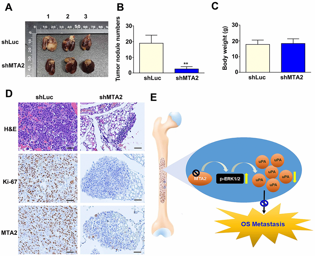 MTA2 depletion inhibits osteosarcoma metastasis in vivo. (A) shLuc- and shMTA2-143B cells (1 × 106 /0.1mL) were injected into the tail vein of C.B17-SCID mice for ten weeks; mice were then sacrificed and the lung tissues removed, shLuc and shMTA2 143B lung tumor excised from C.B17-SCID mice. (B) Number of nodules in lung tumors and (C) body weight among shLuc and shMTA2 mice. (D) H&E staining for tissue morphology and IHC staining for Ki-67 and MTA2 in shLuc and shMTA2 mice. Scale bar: 100 μm. (E) Depiction of the role and biological function of the control of uPA expression by MTA2 in human osteosarcoma metastasis.