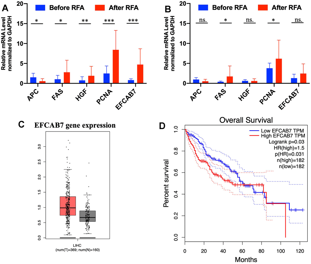 EFCAB7 was upregulated after RFA and was associated with poor prognosis in HCC. (A, B) RT-PCR analysis of EFCAB7, APC, FAS, HGF and PCNA in HCC tumor tissues and adjacent tissues before and after RFA; (C) Expression of EFCAB7 in TCGA database; (D) Kaplan-Meier analysis demonstrated that HCC patients with low EFCAB7 expression had a better overall survival rate than patients with high EFCAB7 expression. Student’s t-test and log-rank test (*P 