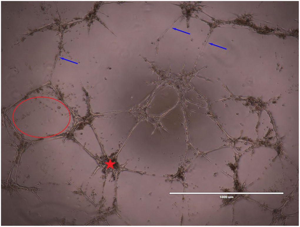 Representative image of BMEC vessel-like formation assay. Images were taken at 10x magnification. Meshes (red outline) and nodes (red star) were automatically analyzed. Meshes were defined as areas enclosed by three or more nodes and nodes were defined as a point where two or more vessels intersect. A blinded analyzer manually measured the number of vessel-like structures (indicated by blue arrows) as well as vessel length.