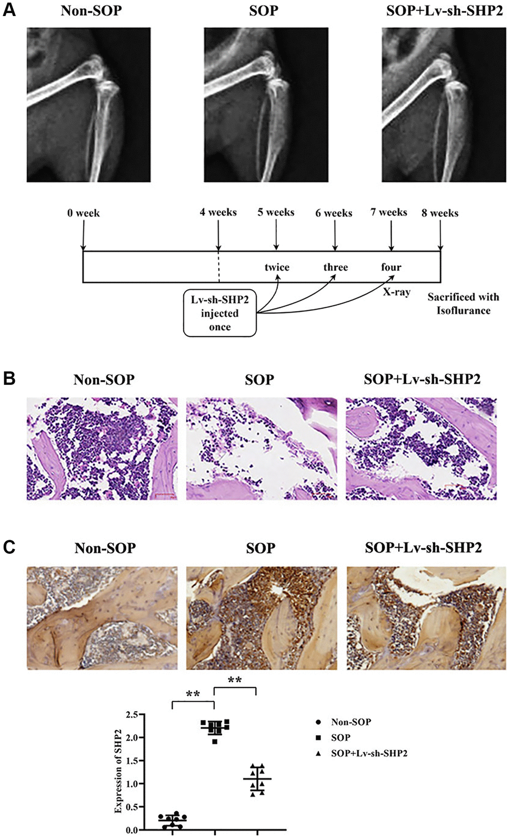 Effects of macrophage-specific knockout of SHP2 on ovariectomy-induced osteoporosis. (A) X-ray imaging was performed to assess bone density, bone quality, trabecular structure, and surface abnormalities in tibiae of mice from different experimental groups. SOP (ovariectomized) mice exhibited lower bone density, thinner bone quality, sparse trabeculae, and surface abnormalities compared to non-SOP mice. Conversely, SOP mice with macrophage-specific SHP2 knockdown (SOP+Lv-sh-SHP2) showed improved bone density, thicker bone quality, and preserved trabecular structure. (B) Hematoxylin and eosin (H&E) staining of vertebral sections revealed decreased cell numbers, enlarged gaps, and thinner trabeculae with fractures in SOP mice compared to non-SOP mice. However, SOP+Lv-sh-SHP2 mice displayed increased cell numbers and more continuous trabeculae. (C) Immunohistochemistry staining showed increased expression of phosphorylated SHP2 (p-SHP2) in SOP mice compared to non-SOP mice. Knockdown of SHP2 in macrophages resulted in decreased p-SHP2 expression, confirming successful knockdown. **P 