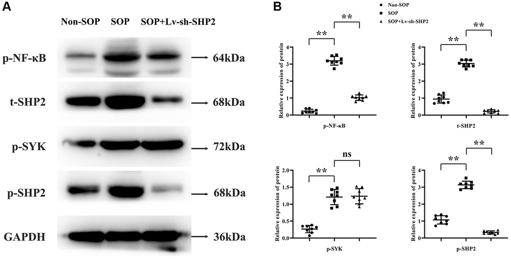 Impact of macrophage-specific SHP2 knockout on kinase activity and transcription factors in ovariectomized mice. (A, B) Western blot analysis was performed on tissue samples to evaluate the protein expression levels of phosphorylated NF-κB (p-NF-κB), spleen tyrosine kinase (p-SYK), and total and phosphorylated SHP2 (t-SHP2 and p-SHP2, respectively). SOP mice showed elevated levels of these proteins compared to non-SOP mice. In contrast, SOP mice with macrophage-specific SHP2 knockdown exhibited reduced levels of p-NF-κB, p-SHP2, and t-SHP2, with unchanged p-SYK levels. **P nsP > 0.05.