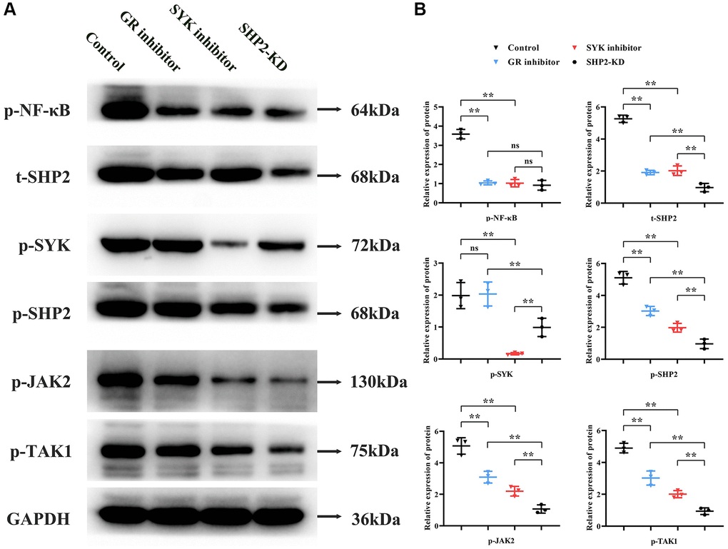 Role of the SYK/SHP2/NF-κB signaling pathway in osteoporosis. (A, B) Western blot analysis of primary cultured BMM cells treated with inhibitors targeting glucocorticoid receptor (GR), SYK, or SHP2 kinase domains (SHP2-KD) was performed. Inhibition of GR, SYK, or SHP2 resulted in decreased phosphorylation levels of NF-κB, SYK, SHP2, JAK2, and TAK1. Notably, SHP2-KD led to reduced p-SHP2, t-SHP2, p-JAK2, and p-TAK1 levels compared to SYK inhibition, suggesting SHP2’s downstream role in the pathway. **P nsP > 0.05.