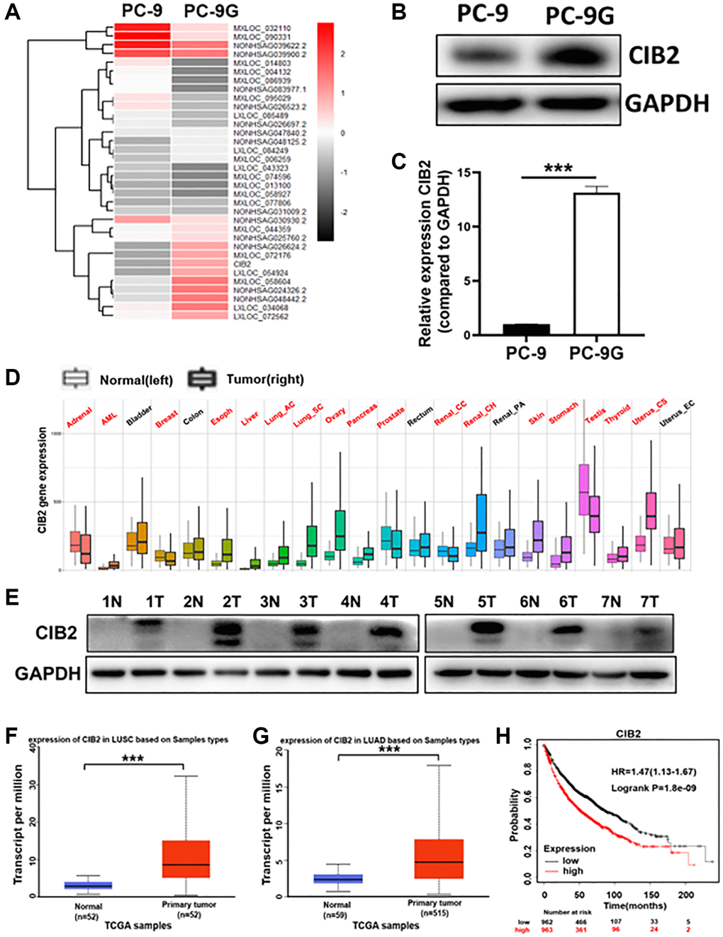 CIB2 expression was dramatically increased in gefitinib-resistant cells and higher CIB2 levels in lung cancer patients were linked to poor prognosis. (A) Heat map of RNA-seq results (PC-9G vs. PC-9). (B, C) CIB2 mRNA and protein expression levels were detected by Western blotting and qRT-PCR in PC-9 and PC-9G cells. (D) The CIB2 expression levels were analyzed and compared in tumor and normal tissues of 22 human cancers by pan-cancer analysis through TNM plot (https://tnmplot.com/analysis/). Significant differences by Mann-Whitney U-test are marked with red. (E) The protein expression of CIB2 in normal and tumor samples obtained from the Biobank. GAPDH levels were used as an internal loading control. (F, G) CIB2 expression in patients of LUAD (normal = 52, tumor = 52) and LUSC (normal = 59, tumor =515) were examined in TCGA database. (H) Kaplan-Meier plot of the overall survival of patients with lung cancer with high or low expression of CIB2 from Kaplan-Meier plotter (http://kmplot.com/analysis/). Data were statistically analyzed using Student’s t-test and values were presented as mean ± SD. ***indicated significant difference at p 