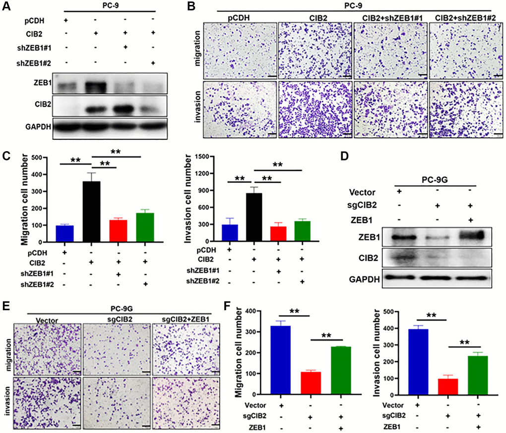 ZEB1 functioned as a downstream regulator in CIB2-induced EMT and chemoresistance. (A) PC-9 cells with stably overexpressed CIB2 were transfected with shZEB1#1 or shZEB1#2 for 48 hours. Western blotting was used to detect the protein expression levels of ZEB1 and CIB2. (B, C) Cell migration and invasion abilities were measured after silencing ZEB1 in CIB2-overexpressed stable PC-9 cells. Quantitative analysis of migration and invasion cell numbers were shown in histogram. (D–F) PC-9G cells with CIB2 knockout were transfected with ZEB1 overexpression plasmid. Cell migration and invasion abilities were measured and analyzed. Data were statistically analyzed using Student’s t-test and values were shown as mean ± SD of three independent experiments. **indicated significant difference at p 