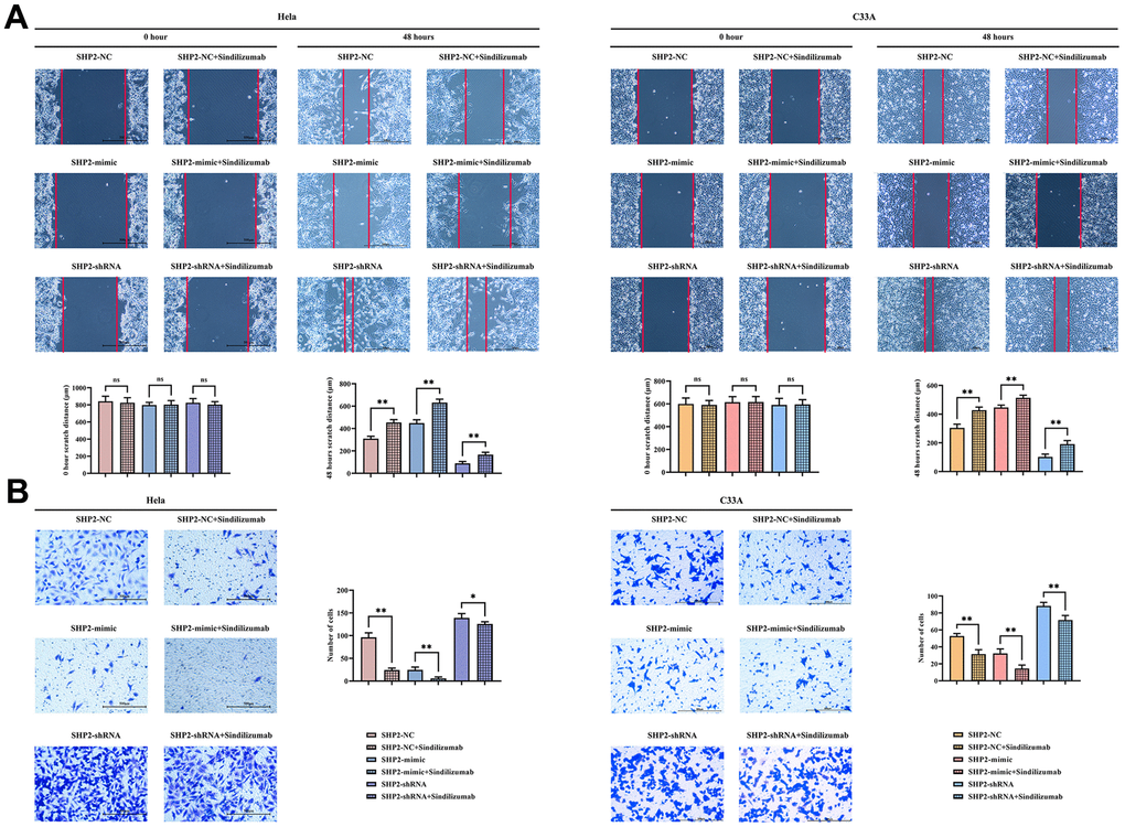 Impact of PD-1 monoclonal antibodies in TAMs on the migration ability of cervical cancer cells. (A) Wound healing results and cell spacing statistics of Hela cells and C33A cells; (B) Transwell migration assay results plot and statistics on the number of migrating cells for Hela cells and C33A cells. Data were expressed as mean±SD. *P0.05.