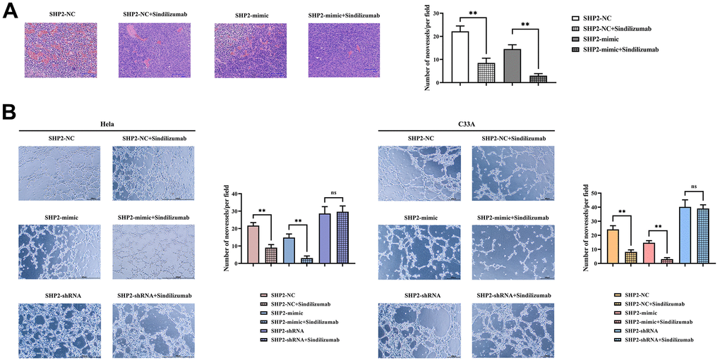 Impact of PD-1 monoclonal antibodies in TAMs on the angiogenic ability of cervical cancer cells. (A) H&E staining results graph and statistical graph of blood vessel numbers; (B) angiogenesis experimental results and vessel count statistics of Hela cells and C33A cells. Data were expressed as mean±SD. *P0.05.