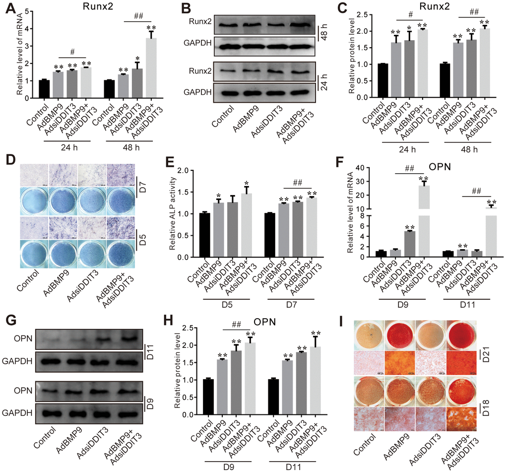 Effects of DDIT3 knockdown on BMP9-induced osteogenic markers in C3H10T1/2 cells. (A) Real-time PCR results show the effect of DDIT3 knockdown on the mRNA level of Runx2 induced by BMP9. (B) Western blot assay results show the effect of DDIT3 knockdown on the protein level of Runx2 induced by BMP9. (C) Quantitative results of Western blot show the effect of DDIT3 knockdown on the protein level of Runx2 induced by BMP9. (D) ALP staining results show the effect of DDIT3 knockdown on the ALP activity induced by BMP9 on day 5 or day 7. (E) Quantitative results of ALP staining show the effect of DDIT3 knockdown on the ALP activity induced by BMP9 on day 5 or day 7. (F) Real-time PCR results show the effect of DDIT3 knockdown on the mRNA expression of OPN induced by BMP9 on day 9 and day 11. (G) Western blot results show the effect DDIT3 knockdown on the protein level of OPN induced by BMP9 on day 9 and day 11. (H) Quantitative results of Western blot assay show the effect DDIT3 knockdown on the protein level of OPN induced by BMP9 on day 9 and day 11. (I) Alizarin red S staining results show the effect of DDIT3 on matrix mineralization induced by BMP9 on day 18 and day 21. “*” p 