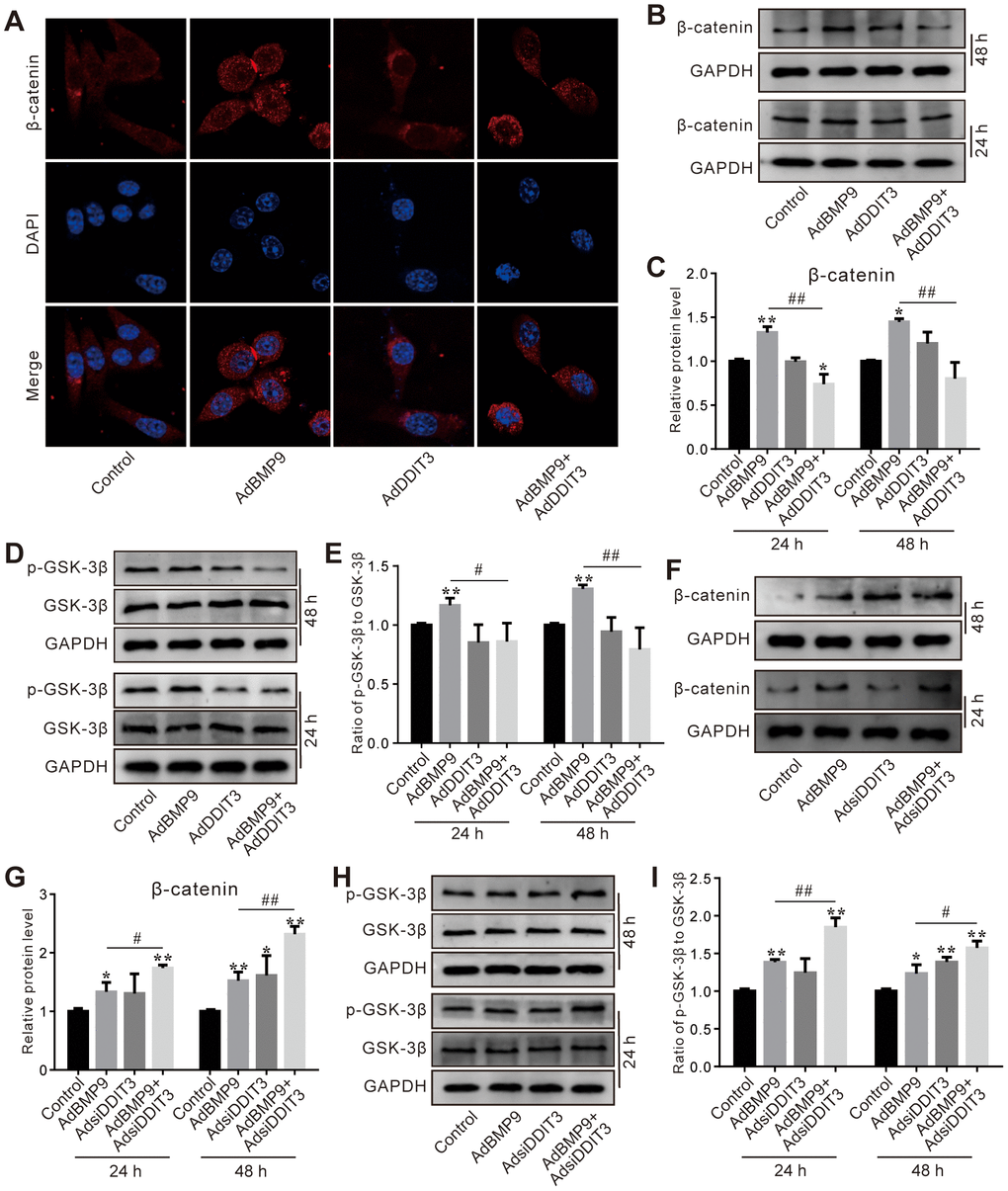 Effects of DDIT3 on Wnt/β-catenin signaling affected by BMP9 in C3H10T1/2 cells. (A) Confocal assay of immunofluorescent staining results shows the effect of DDIT3 on nucleus location of β-catenin induced by BMP9. (B) Western blot assay results show the effect of DDIT3 on the protein level of β-catenin affected by BMP9. (C) Quantitative results of Western blot assay show the effect of DDIT3 on the protein level of β-catenin affected by BMP9. (D) Western blot assay results show the effect of DDIT3 on phosphorylation of GSK-3β (p-GSK-3β) and total GSK-3β induced by BMP9. (E) Quantitative results of Western blot assay show the effect of DDIT3 knockdown on the ratio of p-GSK-3β to GSK-3β affected by BMP9. (F) Western blot assay results show the effect of DDIT3 knockdown on the level β-catenin affected by BMP9. (G) Quantitative results of Western blot assay show the effect of DDIT3 knockdown on the level β-catenin affected by BMP9. (H) Western blot assay results show the effect of DDIT3 knockdown on the protein level and phosphorylation of GSK-3β affected by BMP9. (I) Quantitative results of Western blot assay show the effect of DDIT3 knockdown on the ratio of p-GSK-3β to GSK-3β affected by BMP9. “*” p 