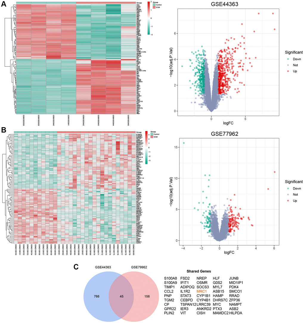 Identification of shared DEGs in GSE44363 and GSE79962 datasets. (A) Heatmap and volcano plot depicting the mRNA expression profile in the GSE44363 dataset. (B) Corresponding heatmap and volcano plot for the GSE79962 dataset. (C) Venn diagram highlights the 45 DEGs common to both datasets.