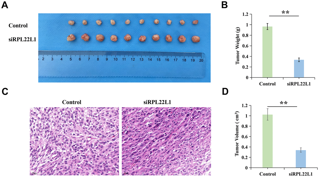 RPL22L1 can increase the growth of xenograft tumors in vivo. (A) Images of tumors in the control group and siRPL22L1 group. (B) Compared with the control group, the siRPL22L1 group showed a significant decrease in tumor weight. (C) Immunohistochemical images of the control group and siRPL22L1 group. (D) The siRPL22L1 group exhibited a statistically significant reduction in tumor volume when compared to the control group. **, P