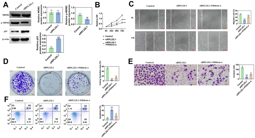 RPL22L1 can activate MDM2/p53. (A) Western blotting showed the effect of PRL22L1 knockdown on the expression of MDM2/p53. (B) The CCK-8 experiment demonstrated the impact of RPL22L1 knockdown in combination with pifithrin-α on the proliferative capacity of A549 cells. (C) The wound healing assay revealed the influence of PRL22L1 knockdown in conjunction with pifithrin-α on the migratory ability of A549 cells. (D) The cloning experiments exhibited the effect of PRL22L1 knockdown in combination with pifithrin-α on the proliferation capability of A549 cells. (E) The transwell experiment demonstrated the impact of PRL22L1 knockdown in conjunction with pifithrin-α on the invasive potential of A549 cells. (F) The flow cytometry analysis revealed the influence of PRL22L1 knockdown in combination with pifithrin-α on the apoptotic ability of A549 cells. *, p 