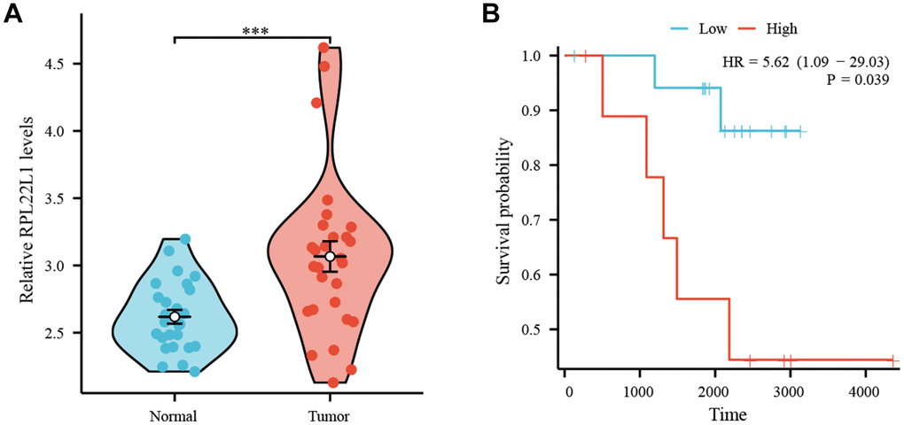 High expression of RPL22L1 in GSE87340 suggests a poor prognosis. (A) The expression of RPL22L1 in GSE87340. (B) OS.