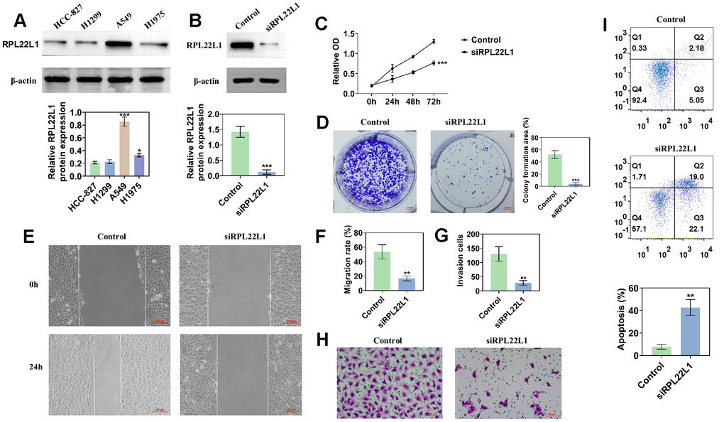 The knockdown of RPL22L1 in A549 cells was found to enhance their proliferation, migration, and invasion. (A) Western blot analysis was conducted to assess the expression of RPL22L1 in LUAD cell lines. (B) The knockdown efficiency of RPL22L1 in A549 cells was evaluated using Western blot analysis. (C) The impact of RPL22L1 knockdown on the viability of A549 cells was determined through a cell viability assay. (D) Cloning experiments were performed to investigate the effect of RPL22L1 knockdown on the proliferation ability of A549 cells. (E, F) The wound healing assay demonstrated the impact of PRL22L1 knockdown on the migratory behavior of A549 cells. (G, H) Transwell assays revealed that RPL22L1 knockdown had the potential to decrease the invasive capabilities of A549 cells. (I) Flow cytometry analysis provided insights into the influence of PRL22L1 knockdown on apoptosis in A549 cells. Statistical significance was denoted by *p 