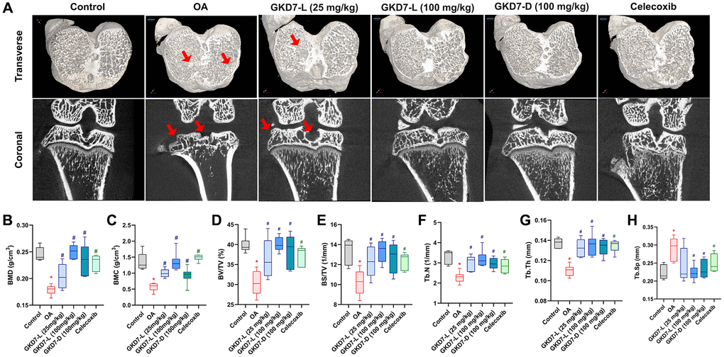 Therapeutic effects of GKD7 treatment evaluated by micro-CT. (A) Rat knee coronal and transverse micro-CT investigates from the control, OA, OA +GKD7-L (25 mg/kg), OA +GKD7-L (100 mg/kg), and OA +GKD7-D (100 mg/kg) groups. (B–H) Quantitative evaluations of bone surface/total volume (BS/TV), bone volume/total volume (BV/TV), bone mineral density (BMD), bone mineral content (BMC), bone volume/total volume (BV/TV), trabecular thickness (Tb.Th), trabecular number (Tb.N), and trabecular separation (Tb.Sp). The red arrows indicate bone erosion. *p #p 