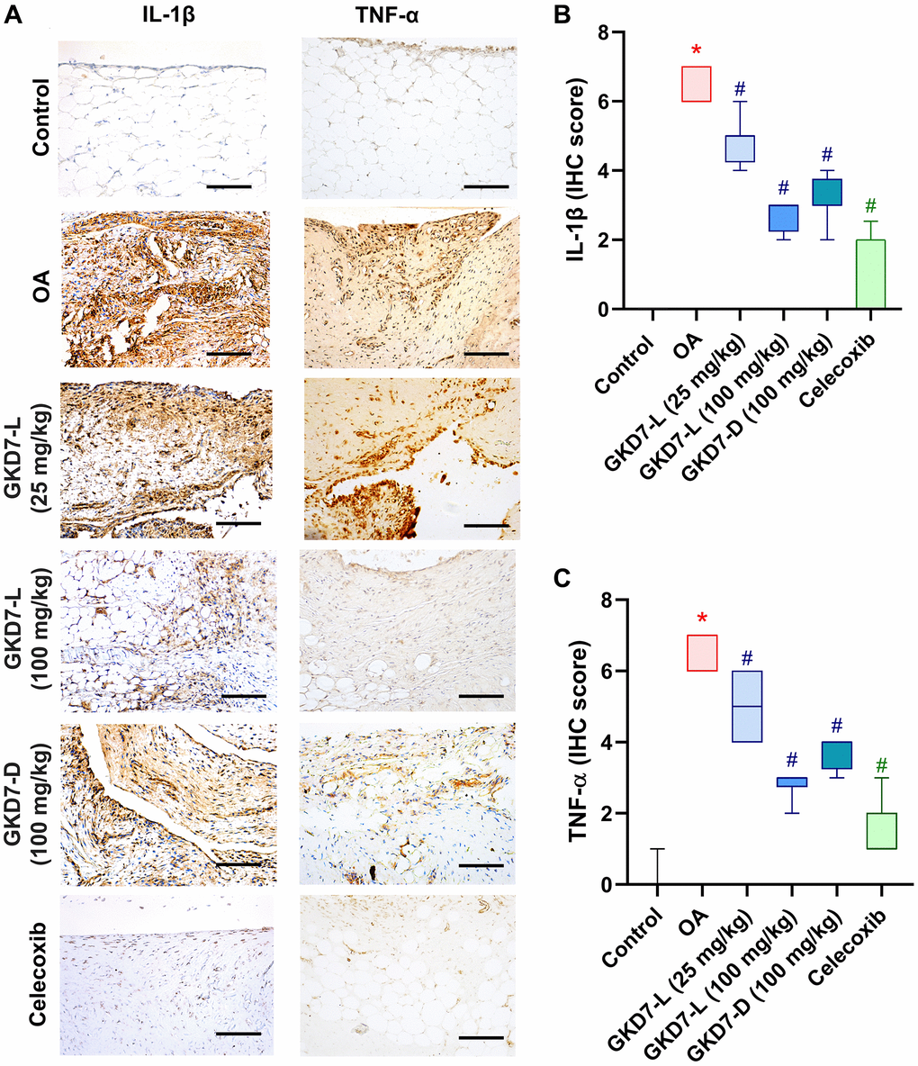 Administration of GKD7-L and GKD7-D reduced levels of TNF-α and IL-1β expression on synovial tissue. (A) IHC staining of TNF-α and IL-1β expression in a representative synovial tissue sample from the control, OA, OA+GKD7-L (25 mg/kg), OA+GKD7-L (100 mg/kg), and OA+GKD7-D (100 mg/kg) groups. Quantitative evaluations of cartilage’s TNF-α and IL-1β (B, C). Values are presented as the mean ± SD for each group. Scale bar = 100 µm. *p #p 