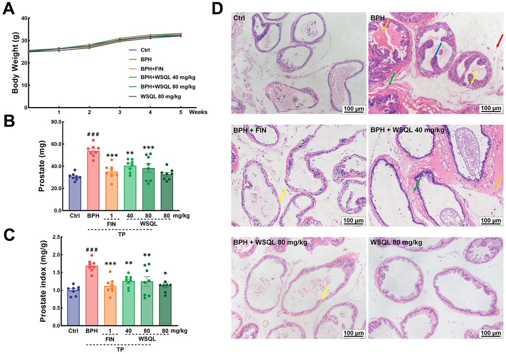 Effect of WSQL on prostate injury and hyperplasia in TP-induced BPH model mice. (A) Body weight, (B) prostate weight and (C) prostate index changed in mice during the experiment. (D) H&E staining of prostate tissues. Yellow arrow: epithelial cell degeneration; Green arrow: hyperplasia of connective tissue with tight arrangement; Orange arrow: eosinophilic exudate; Red arrow: inflammatory cell infiltration; Blue arrow: epithelial cell hyperplasia with papillary projection. Magnification: 200×, scale bar: 100 μm. ###p p p n = 8 for (A–C) and n = 3 for (D).