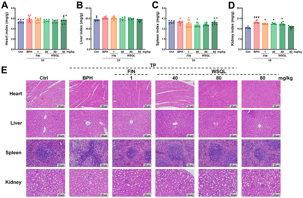 In vivo security of WSQL. The indexes of (A) heart, (B) liver, (C) spleen and (D) kidney. (E) H&E staining of heart, liver, spleen and kidney. Magnification: 200 ×, scale bar: 100 μm. The data are presented as the mean ± SEM. ###p p n = 8 for (A–D) and n = 3 for (E).