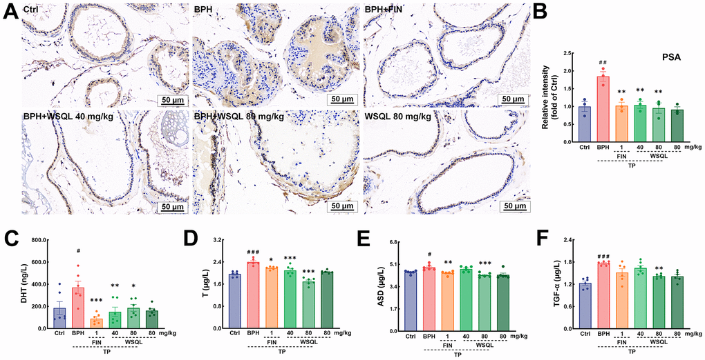 WSQL improved BPH symptoms and reduced serum hormone and growth factor levels. (A) IHC staining for PSA in prostate. Magnification: 200×, scale bar: 50 μm. (B) Quantitative analyses of IHC staining for PSA in prostate were reported as the fold change of the Ctrl group. Effect of WSQL on levels of (C) DHT, (D) T, (E) ASD and (F) TGF-α in serum. The data are presented as the mean ± SEM. ###p ##p #p p p p n = 3 for (A) and (B) and n = 6 for (C–F).