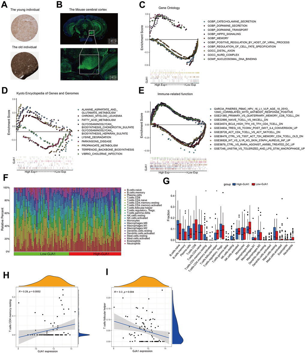 Functional exploration of GJA1 at the single-gene level. (A) Immunohistochemistry results demonstrating the expression of GJA1 in older populations. (B) Immunofluorescence demonstrating the enrichment of mouse brain tissue for GJA1 in the cortex. (C) GO analysis of GJA1. (D) KEGG analysis of GJA1. (E) Immune-related function analysis of GJA1. (F) Percentage of immune cells in the immune cell ratio between groups with high and low expression of GJA1 in Temporal Cortex. (G) Lymphocyte subpopulation occupancy in the two groups. (H, I) Correlation between lymphocyte subpopulation and GJA1 in the two groups.