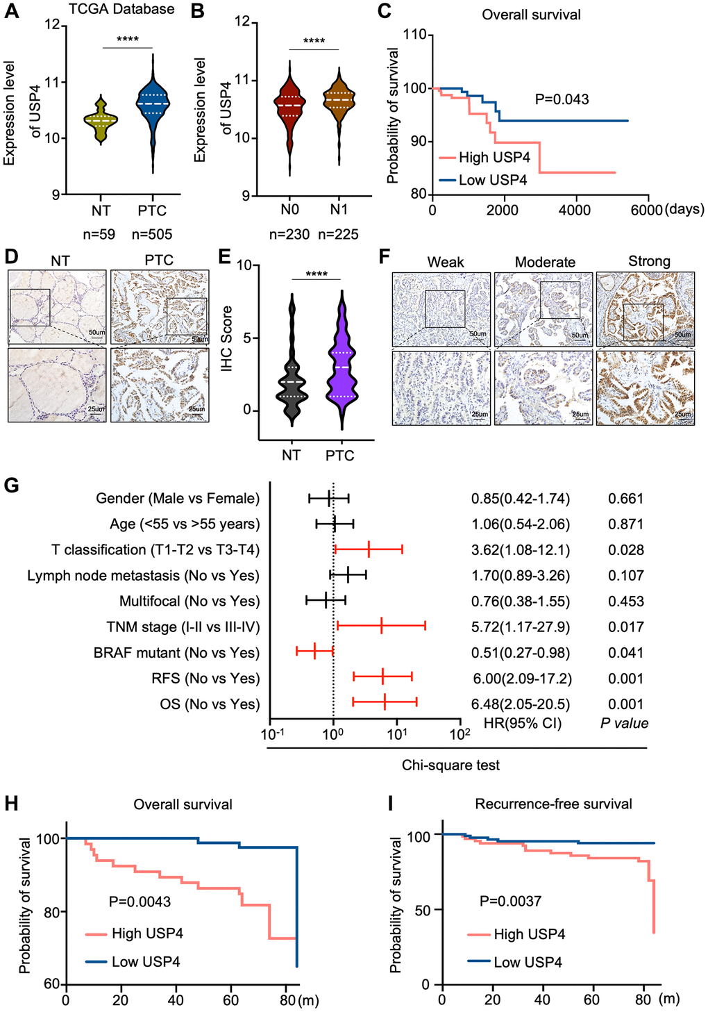 Correlations between USP4 expression and clinical features of PTC patients. (A) Violin plot depicting USP4 gene expression levels in PTC and adjacent normal thyroid tissues sourced from the TCGA database; (B) Comparison of USP4 mRNA expression levels across different N stages in PTC tissues, as sourced from the TCGA database; (C) Kaplan-Meier curve estimating overall survival rates of PTC patients from the TCGA database, stratified by varying USP4 expression levels; (D) Representative IHC staining images showing USP4 expression in PTCs and their corresponding normal tissues; (E) Statistical quantification of IHC scores for USP4 expression in PTCs and their corresponding normal tissues; (F) Representative IHC images showing weak, moderate, and strong staining of USP4 in PTCs; (G) Univariate analysis examining the associations between USP4 protein levels and clinicopathologic features in PTC patients from the validation cohort. Red lines denote clinicopathologic features significantly associated with USP4 expression. (H, I) Kaplan-Meier curves for overall survival (OS) and recurrence-free survival (RFS) illustrating PTC patient outcomes in relation to high versus low USP4 expression levels. All *p **p ***p ****p 