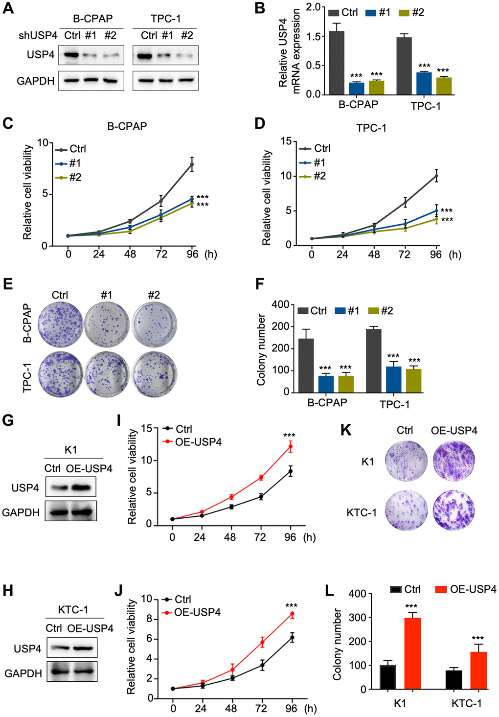 USP4 promotes the proliferation of PTC. (A) Western blot analysis to determine the knockdown efficiency of USP4 in B-CPAP and TPC-1 cells; (B) qPCR analysis to determine the knockdown efficiency of USP4 in B-CPAP and TPC-1 cells; (C, D) CCK-8 assay to assess the proliferative capacity of B-CPAP and TPC-1 cells following USP4 knockdown; (E) Representative images from colony formation assays of B-CPAP and TPC-1 cells with USP4 knockdown; (F) Statistical quantification of colony numbers in B-CPAP and TPC-1 cells with USP4 knockdown; (G, H) Western blot analysis to determine USP4 overexpression in K1 and KTC-1 cells; (I, J) CCK-8 assay to assess the proliferative capacity of K1 and KTC-1 cells expressing USP4; (K) Representative images from colony formation assays of K1 and KTC-1 cells expressing USP4; (L) Statistical quantification of colony numbers in K1 and KTC-1 cells expressing USP4. All *p **p ***p ****p 