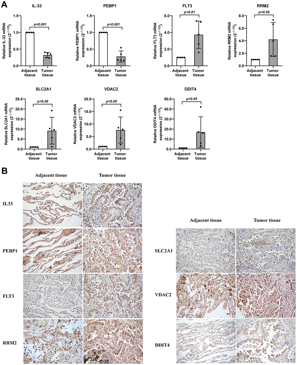 Validation of the expression levels of seven genes in lung adenocarcinoma. (A) RT-qPCR assay detected mRNA levels of the seven genes related with ferroptosis in lung adenocarcinoma. (B) Immunohistochemistry assay detected protein levels of the seven genes related with ferroptosis in lung adenocarcinoma. * represents P P P 