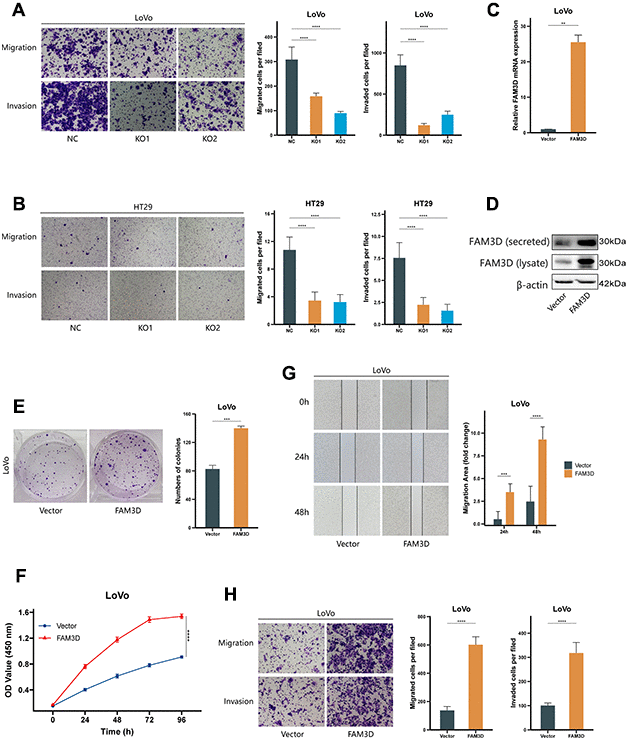 FAM3D promotes CRC cell proliferation, migration, and invasion in vitro. (A, B) Migration and invasion were detected by transwell assays in (A) LoVo and (B) HT29 cells. (C, D) Overexpression of FAM3D was confirmed by (C) RT-qPCR and (D) Western blot in LoVo cells. (E, F) Proliferation was detected after FAM3D overexpression. (G, H) Migration and invasion were detected after FAM3D overexpression. **P P P 