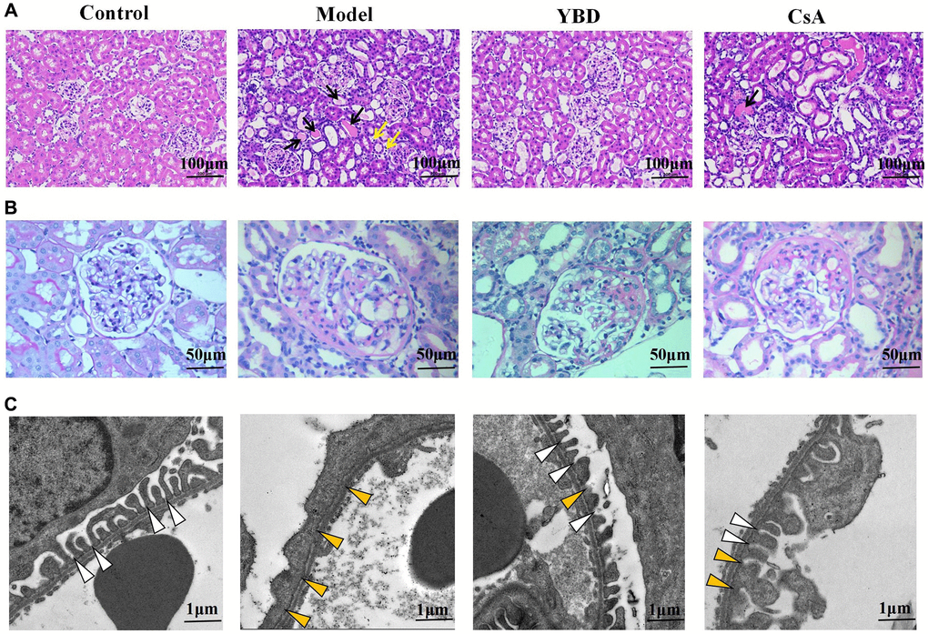 Effects of YBD on renal histopathology in NS rats. (A) Morphological observations with HE-stained in renal tissue of the four different groups (magnification×200). Protein casts were indicated by black arrows and inflammatory cell infiltration was indicated by yellow arrows. (B) Morphological observations with PAS-stained in renal tissue of the four different groups (magnification × 400). (C) Representative images of podocyte foot processes observed by transmission electron microscopy in different groups. The magnification of transmission electron microscopy was 5000. The normal structure of foot processes was marked by white arrow head, the effacement and fusion of foot processes were marked by yellow arrow head.