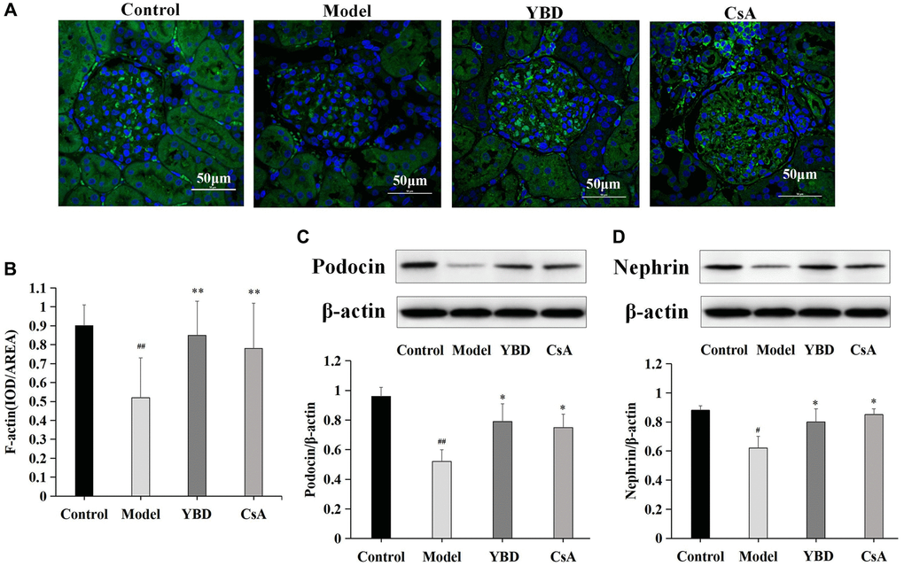  (A) F-actin in renal cortex tissues from different groups was shown by confocal microscopy (magnification × 600). Green staining showed positive expression of F-actin, and blue staining showed positive expression of cell nucleus. (B) The area of F-actin in different groups. (C, D) Western blotting analysis for the protein expression levels of podocin and nephrin in renal cortex tissues from different groups. As an internal control respectively, β-actin was used to calculate the quantification of protein. Data were expressed as mean ± SD, n = 6. Vertical bars represent the standard deviation. #p ##p *p **p 