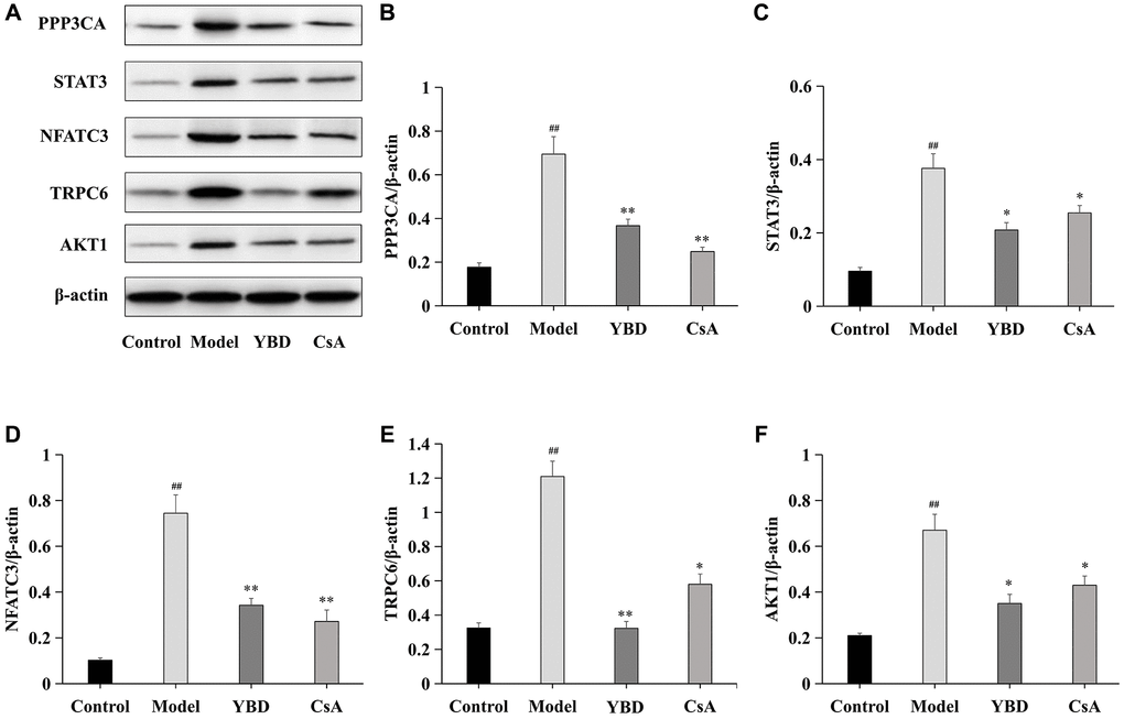 Effects of YBD on the expressions of core targets in NS rats induced by PAN. (A–F) The relative protein expressions of PPP3CA, STAT3, NFATC3, TRPC6, and AKT1 were measured by Western blotting. As an internal control respectively, β-actin was used to calculate the quantification of protein. Data were expressed as mean ± SD, n = 6. Vertical bars represent the standard deviation. #p ##p *p **p 