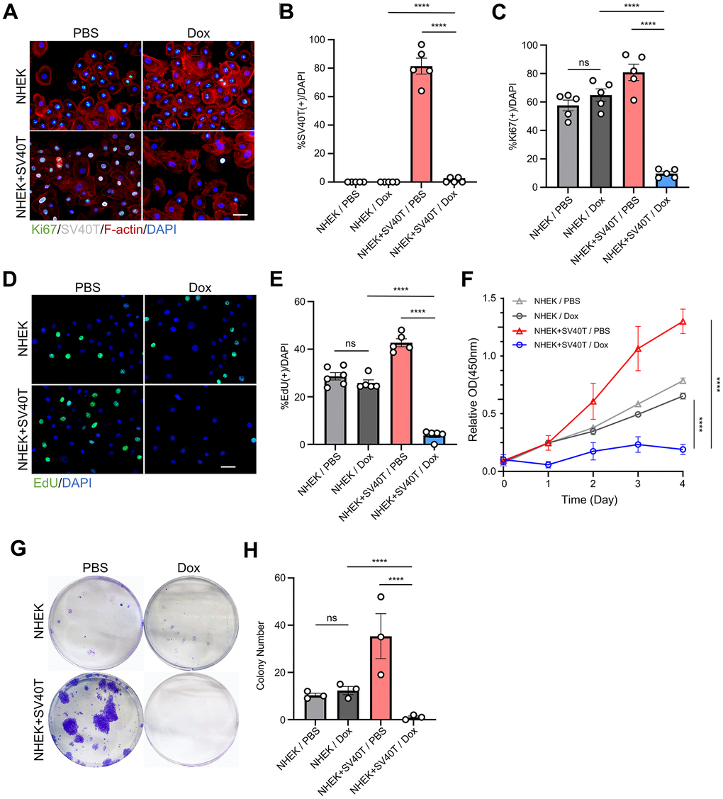 Terminating the expression of SV40T antigen with doxycycline induction in reversibly immortalized NHEK resulted in reduced mitotic ability. (A) Immunofluorescent staining of Ki67, SV40-T, F-actin and DAPI of NHEKs and reversibly immortalized keratinocytes with PBS or Dox treatment. Scale bar = 20 μm. (B, C) Statistical analysis for (A) (****P D) EdU staining analysis of NHEKs and reversibly immortalized keratinocytes with PBS or Dox treatment. Scale bar = 20 μm (****P E) Statistical analysis for (D) (****P F) CCK-8 assay for NHEKs and reversibly immortalized keratinocytes treated with either doxycycline (Dox) or PBS control (****P G) Clone formation assay for NHEKs and reversibly immortalized keratinocytes treated with either Dox or PBS control. (H) Statistical analysis for (G) (****P 