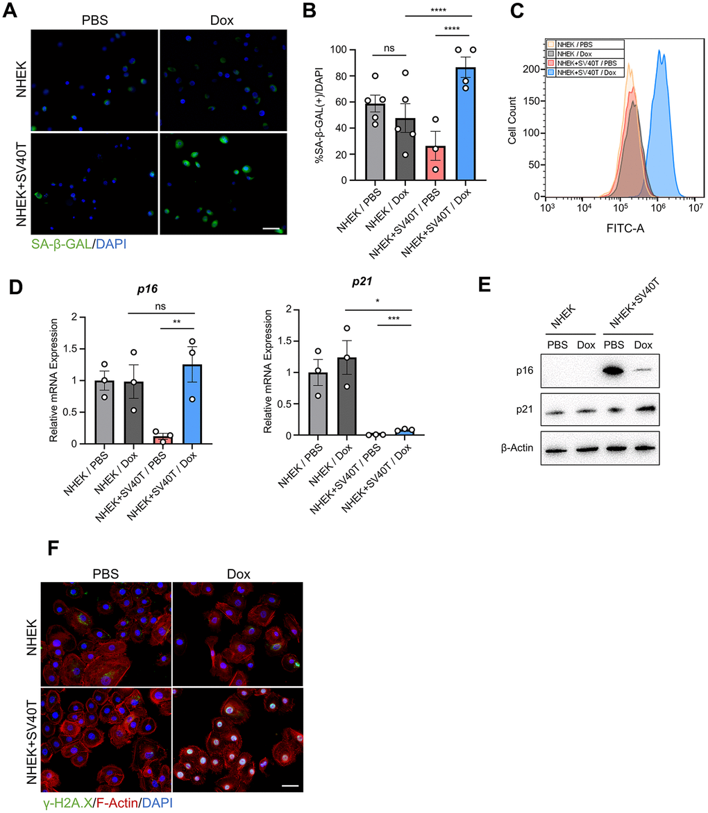 Immortalized NHEK with terminated expression of SV40T showed phenotypes of cell senescence. (A) Immunofluorescence detection of SA-β-GAL in NHEKs and reversibly immortalized keratinocytes with PBS or Dox treatment. Scale bar = 20 μm. (B) Statistical analysis of (B) (****P C) Flow cytometry analysis of SA-β-GAL in NHEKs and reversibly immortalized keratinocytes with PBS or Dox treatment. (D) mRNA levels of p16 and p21 were tested by qPCR with corresponding treatment (*P P P P E) Protein levels of p16 and p21 were tested by Western blot in NHEKs and reversibly immortalized keratinocytes with corresponding treatment. (F) Immunofluorescent staining of γ-H2A.X, F-actin and DAPI of NHEKs and reversibly immortalized keratinocytes with PBS or Dox treatment. Scale bar = 20 μm.