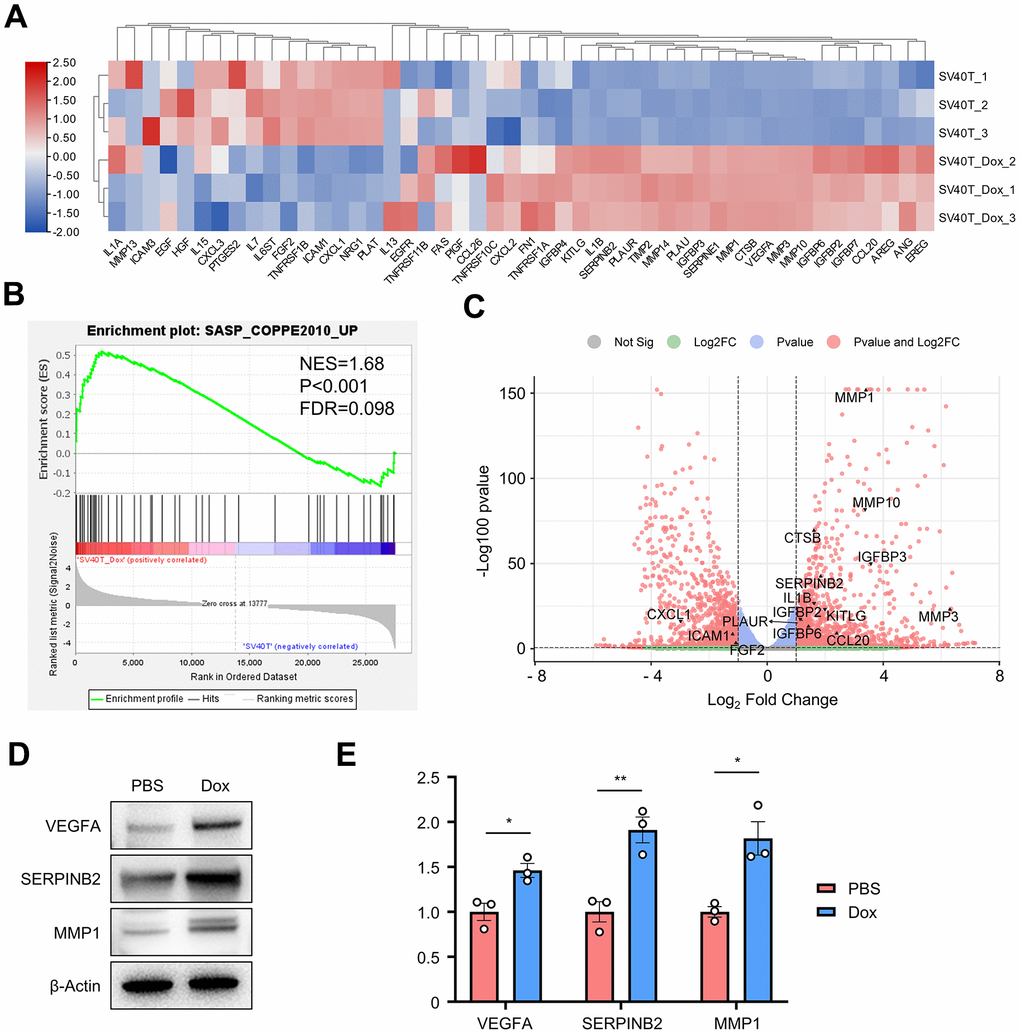 Gene set enrichment analysis revealed enrichment of SASP-related genes set in the DEGs. (A) Gene expression heatmap of SASP-related genes in reversibly immortalized NHEK with PBS or Dox treatment. (B) GSEA results of SASP gene set. (C) Volcano plot of up- or downregulated genes in reversibly immortalized NHEK with PBS or Dox treatment with significant genes in SASP gene set annotated. (D) Protein levels of VEGFA, SERPINB2 and MMP1 were tested by Western blot in reversibly immortalized keratinocytes with PBS or Dox treatment. (E) mRNA levels of VEGFA, SERPINB2 and MMP1 were tested by qPCR in reversibly immortalized keratinocytes with PBS or Dox treatment.